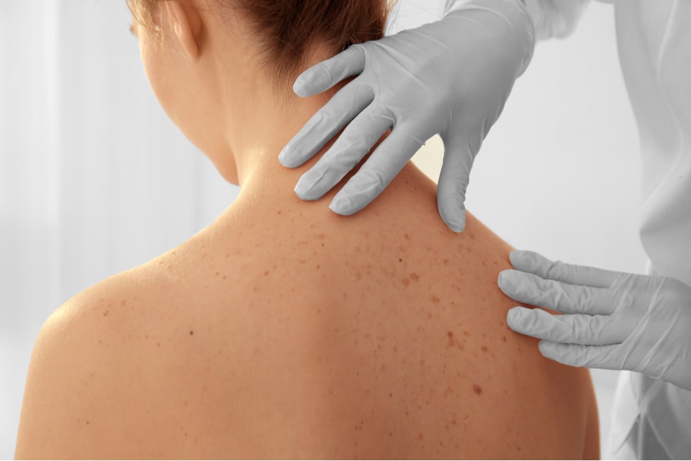 Dermatólogo examinando la espalda de una paciente